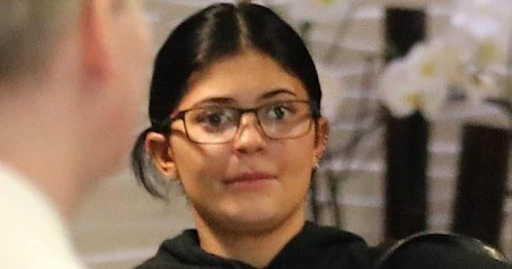 kylie-jenner-cirugias-plasticas
