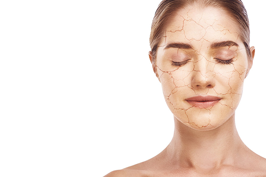 ¿Conoces la diferencia entre piel seca y piel deshidratada?