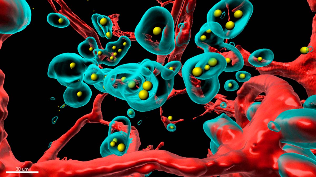 Crean un virus que 'engaña' al cáncer para que se destruya a sí mismo