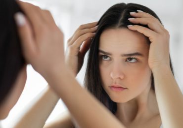Caída del cabello: cuáles son las causas y cómo tratarlas