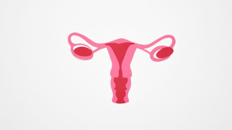 ¿Cómo saber si padezco ovario poliquístico?